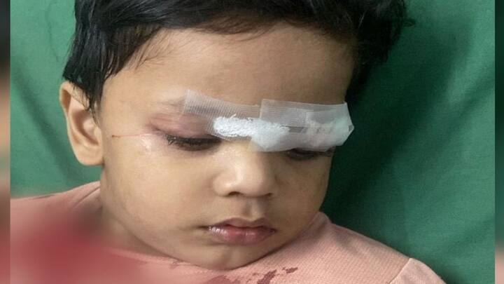अगर दोपहिया चलाते समय मांझा शरीर में उलझ जाए तो तुरंत ब्रेक लगाकर गाड़ी रोकें. चलते वाहन पर मांझा हटाने की कोशिश न करें. बाइक रोकने के बाद ही धीरे-धीरे मांझा हटाएं. अगर कहीं कट लग गया हो तो साफ कपड़े से उस जगह को दबाएं जिससे खून का बहाव कम हो सके.