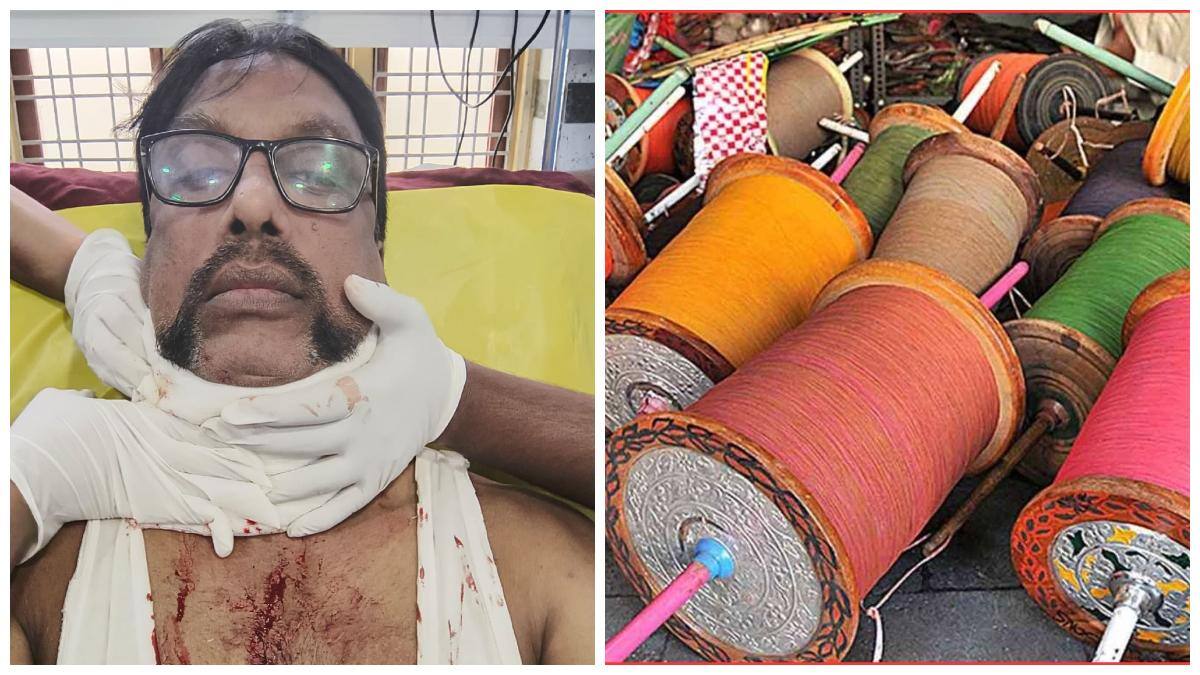 Hyderabad Crime News: హైదరాబాద్‌లో పోలీసు మెడను కోసేసిన చైనా మాంజా-ఆసుపత్రిలో చికిత్స