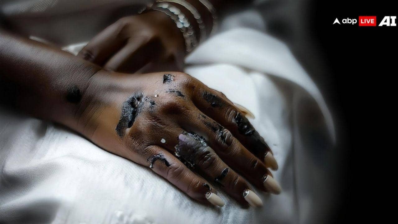 Bengal: 70 साल के बुजुर्ग ने बहू और समधन को कुल्हाड़ी से काटा, सोते वक्त किए वार, घर नहीं था बेटा