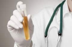 પેશાબના રંગમાં અચાનક ફેરફાર લીવર કેન્સરનું જોખમ ? જાણો અહીં