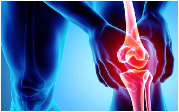 સોજો: સાંધાની આસપાસની પેશીઓમાં  સોજો આવવાની સાથે અસહ્ય દુખાવો થાય છે