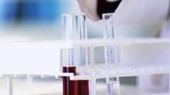 Diabetes Care: আপনার HbA1c পরীক্ষায় মাত্রা কি এই শতাংশের মধ্যে ? কোন ক্ষেত্রে এটি বিপজ্জনক ?