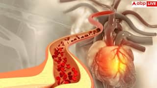High Cholesterol: इस बीमारी में भी राहत देती है कोलेस्ट्रॉल की यह दवा, नई स्टडी में सामने आई चौंकाने वाली बात