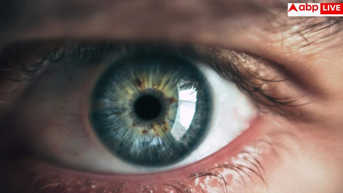 Burning Eyes Reasons: घंटों नहीं देखते स्क्रीन तो क्यों सूख रही हैं आपकी आंखें? जानिए ड्राई आई के छिपे कारण