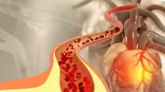 High Cholesterol Care: কোলেস্টেরল রিপোর্ট স্বাভাবিক, তবুও এই রোগের ঝুঁকি থাকতে পারে ? সাবধান !