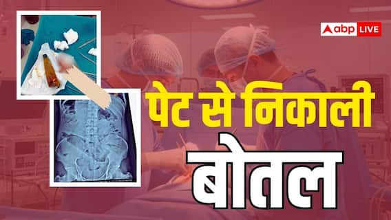 अंबेडकर नगर: शरीर के अंदर युवक ने पेट में डाल ली बोतल, डॉक्टरों ने सर्जरी कर बचाई जान