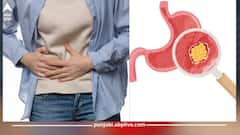 Health News : ਪੇਟ ਦੇ ਕੈਂਸਰ ਕਰਕੇ ਚਮੜੀ 'ਤੇ ਨਜ਼ਰ ਆਉਣ ਲੱਗਦੇ ਅਜਿਹੇ ਲੱਛਣ, ਇੰਝ ਕਰੋ ਬਚਾਅ