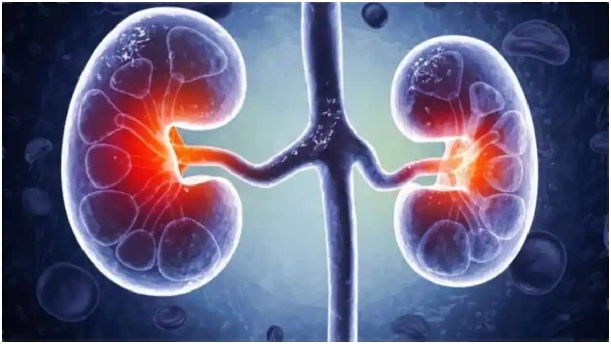 Kidney Disease : సైలెంట్‌గా పెరుగుతున్న కిడ్నీ వ్యాధులు.. ఈ లక్షణాలను అస్సలు విస్మరించొద్దు, నిపుణుల సూచనలివే