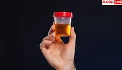 Blood In Urine : ਜੇਕਰ ਪਿਸ਼ਾਬ 'ਚ ਆ ਰਿਹਾ ਖੂਨ ਤਾਂ ਹੋ ਸਕਦਾ ਹੈ ਕੈਂਸਰ , ਤੁਰੰਤ ਕਰਵਾਓ ਇਹ ਟੈਸਟ