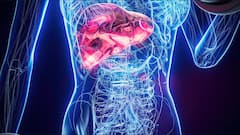 Liver Swelling Symptoms: લીવરમાં સોજો આવે ત્યારે કયા લક્ષણો દેખાય છે?