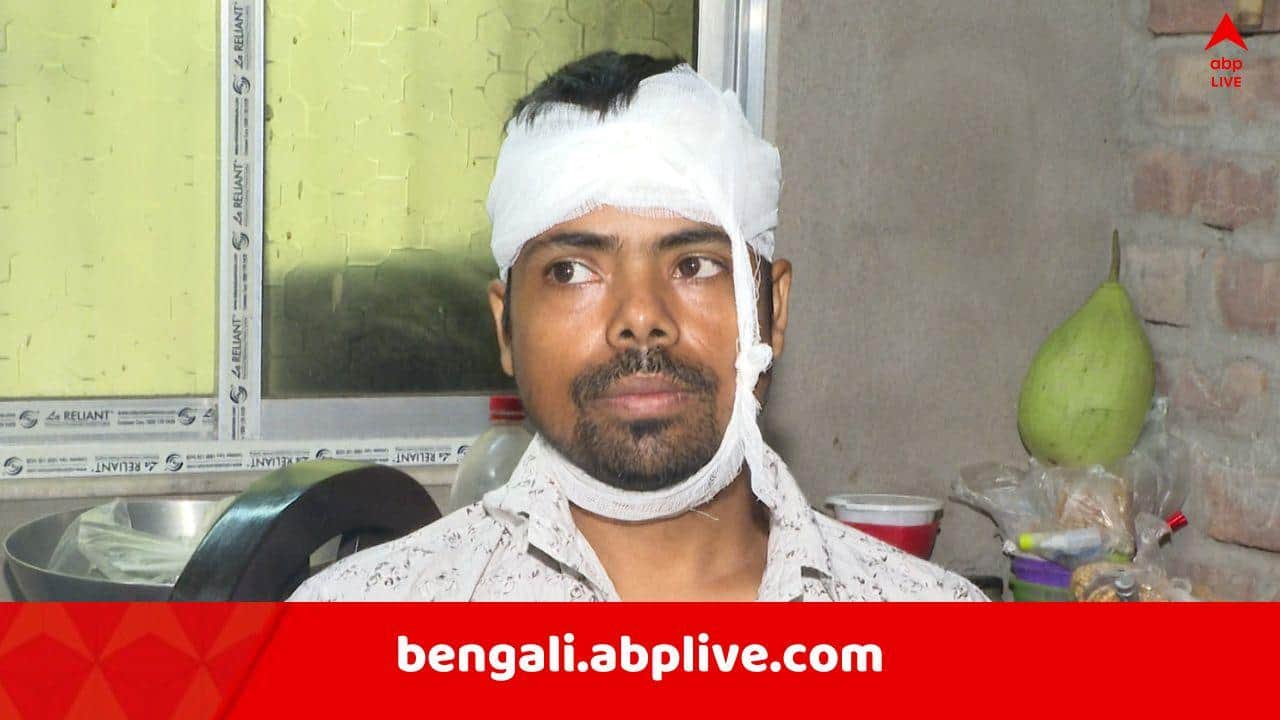 Jadavpur News: "প্রতিবাদীর গায়ে পেট্রোল ঢেলে আগুন লাগানোর চেষ্টা.."! একাধিক স্থানীয় বাসিন্দাকে 'কোপ', চলল গুলি, হাড়হিম করা ঘটনা যাদবপুরে, ঘটনাস্থলে কেন্দ্রীয় বাহিনী