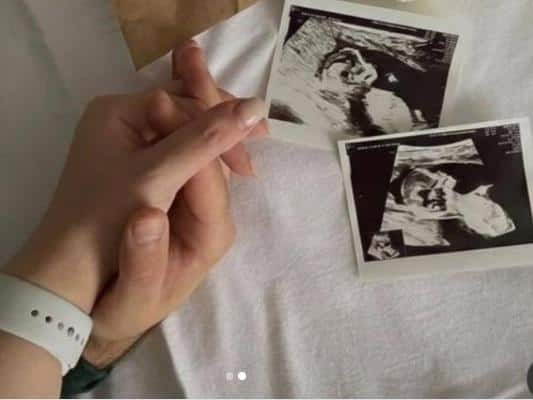 This 'Naagin' of TV is going to become a 'mother' of twins, gave good news to the fans by sharing the post