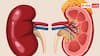 Kidney Health: यूरिक एसिड vs क्रिएटिनिन...किडनी की हेल्थ के दो अहम संकेत, जिन्हें समझना है जरूरी