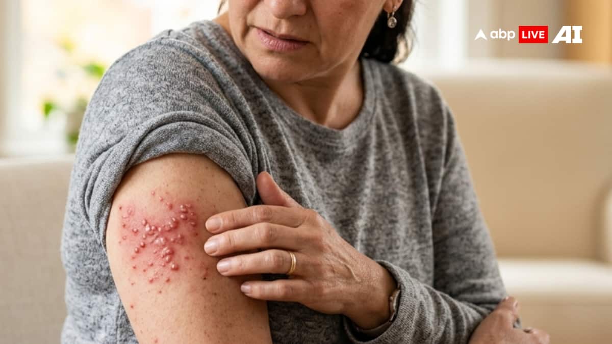ABP Live Doc Talk | Shingles In Older People: Know Why Prevention Is Crucial For Healthy Ageing