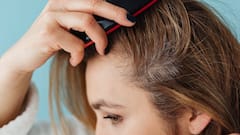 Scalp Sunburn: सिर्फ त्वचा ही नहीं, स्कैल्प भी हो सकता है सनबर्न का शिकार, एक्सपर्ट बोले- इसे न करें नजरअंदाज