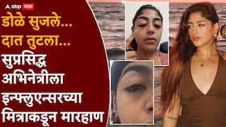 MTV Splitsvilla 16 Preet Singh Physically Assaulted: डोळे सुजले, दात तुटला; सुप्रसिद्ध अभिनेत्रीला इन्फ्लुएन्सरच्या मित्राकडून मारहाण, चेहऱ्यावरचे व्रण पाहून चाहते हादरले VIDEO