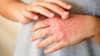 Summer Heat rash: கொளுத்தும் வெயிலால் ஏற்படும் சரும அரிப்பு.. தடுக்க ஈஸி டிப்ஸ் இதோ!