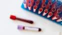 Thalassaemia: કયા દેશના લોકોમાં થેલેસીમિયા થવાનો ખતરો છે સૌથી વધુ, જાણો શું છે આનું કારણ ?