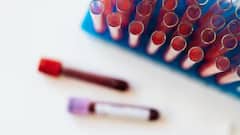 Thalassaemia: કયા દેશના લોકોમાં થેલેસીમિયા થવાનો ખતરો છે સૌથી વધુ, જાણો શું છે આનું કારણ ?