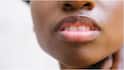 Dark Lips : నల్లగా ఉన్న పెదవులను సహజంగా పింక్‌గా మార్చే ఇంటి చిట్కాలు