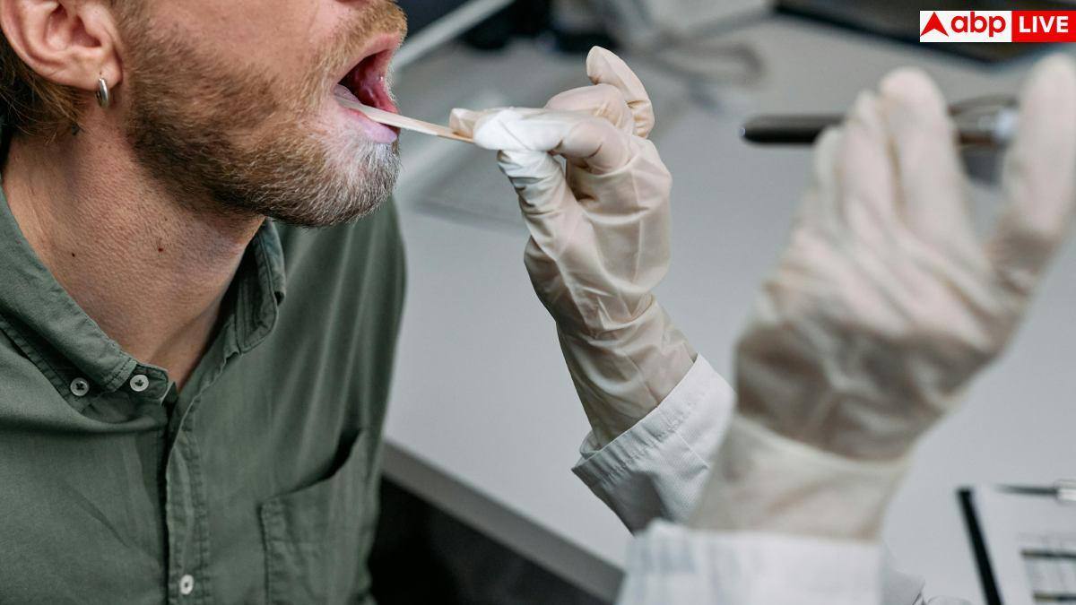 Mouth Cancer In Young Adults: नॉन-स्मोकर्स युवाओं में तेजी से फैल रहा ओरल कैंसर, इन लक्षणों को कतई न करें इग्नोर