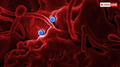 अफ्रीका में बढ़ते Ebola केसों के बीच भारत की एंट्री, Bundibugyo वैक्सीन बनाने में जुटा सीरम इंस्टीट्यूट