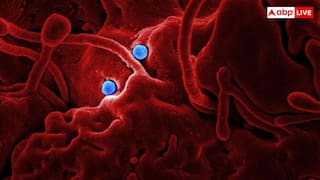 Africa Ebola outbreak: अफ्रीका में बढ़ते Ebola केसों के बीच भारत की एंट्री, Bundibugyo वैक्सीन बनाने में जुटा सीरम इंस्टीट्यूट