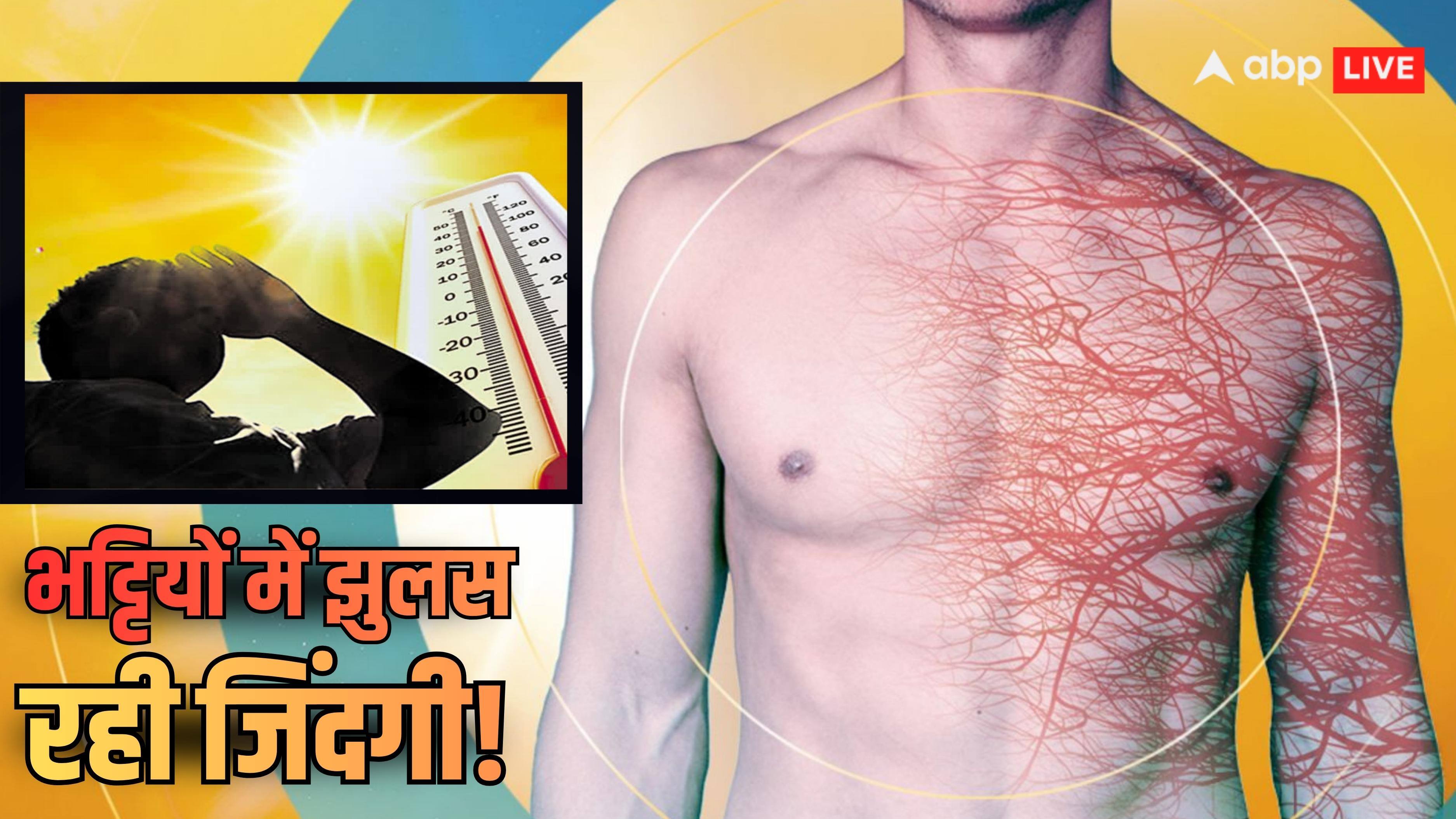 Explained: आंत-पेट में ऑक्सीजन पहुंचना बंद, शरीर में खून के थक्के और किस्सा खत्म! कितनी गर्मी झेलने के बाद कैसे हो जाती मौत?