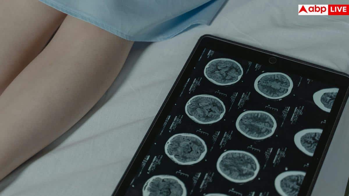 Multiple Sclerosis: 20 से 40 की उम्र में थकान-झनझनाहट दे अलर्ट तो समझें गंभीर बीमारी का संकेत, एक्सपर्ट की चेतावनी