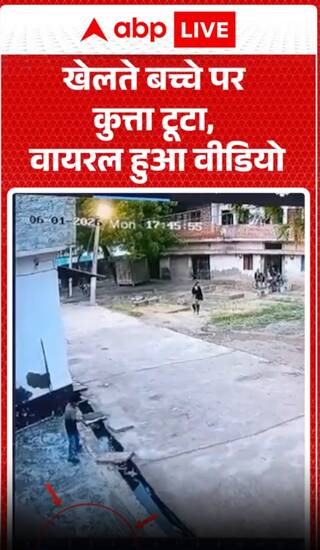 Dog attacks playing child, video goes viral