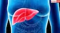 ਸ਼ਹਿਰੀ ਭਾਰਤ 'ਚ ਹਰ ਤੀਜਾ ਵਿਅਕਤੀ Fatty Liver ਦਾ ਸ਼ਿਕਾਰ, ਨਜ਼ਰਅੰਦਾਜ਼ ਕੀਤਾ ਤਾਂ ਹੋ ਸਕਦਾ ਕੈਂਸਰ