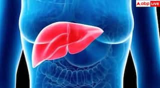 ਸ਼ਹਿਰੀ ਭਾਰਤ 'ਚ ਹਰ ਤੀਜਾ ਵਿਅਕਤੀ Fatty Liver ਦਾ ਸ਼ਿਕਾਰ, ਨਜ਼ਰਅੰਦਾਜ਼ ਕੀਤਾ ਤਾਂ ਹੋ ਸਕਦਾ ਕੈਂਸਰ