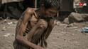 Food Starvation Effects: कितने दिन तक भूखा रह सकता है इंसान, कब जानलेवा हो जाती है भूखमरी?