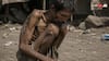 Food Starvation Effects: कितने दिन तक भूखा रह सकता है इंसान, कब जानलेवा हो जाती है भुखमरी?