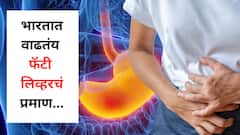 भारतात वाढतंय फॅटी लिव्हरचं प्रमाण; लठ्ठपणा आणि मधुमेहाशी आहे थेट संबंध, वाचा तज्ज्ञांचं मत