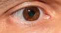 Eye Floaters Warning Signs: कम उम्र में आंखों के सामने दिख रहे काले धब्बे, जानें Eye Floaters कब बन सकते हैं खतरे की घंटी?