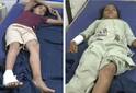 Morbi Accident: હળવદમાં નશામાં ધૂત બુલેટચાલકે 4 વિદ્યાર્થિનીઓને કચડી, 11 વર્ષીય રોશનીનું મોત