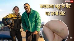 'खतरों के खिलाड़ी 15 में स्टंट के दौरान फरहाना भट्ट हुईं घायल, पैर में लगी चोट
