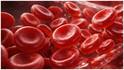 Hemoglobin Increasing Tips : హెమోగ్లోబిన్ తక్కువగా ఉందా? పెరగాలంటే ఈ చిట్కాలు తప్పక పాటించండి