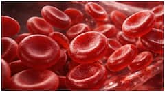 Hemoglobin Increasing Tips : హెమోగ్లోబిన్ తక్కువగా ఉందా? పెరగాలంటే ఈ చిట్కాలు తప్పక పాటించండి