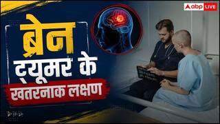 Brain Tumor Symptoms: मामूली सिरदर्द कब बन जाता है गंभीर खतरा? डॉक्टर से जानें ब्रेन ट्यूमर के छिपे हुए लक्षण