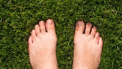 Toe Hair Facts: পায়ের আঙুলে লোম থাকে কেন, ভাল না খারাপ?