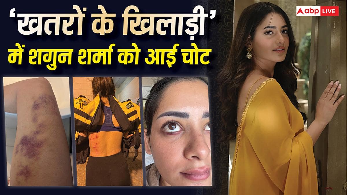 'खतरों के खिलाड़ी 15' की शूटिंग में शगुन शर्मा की हुई ऐसी हालत, शरीर पर आई चोटें, फोटोज हुईं वायरल