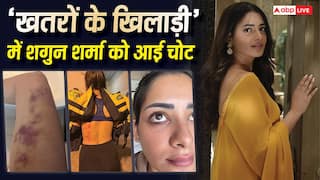 'खतरों के खिलाड़ी 15' की शूटिंग में शगुन शर्मा की हुई ऐसी हालत, शरीर पर आई चोटें, फोटोज हुईं वायरल