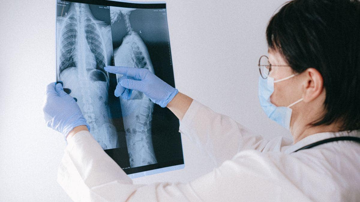 What Is Popcorn Lung? Experts Explain The Rare Disease, Symptoms And Treatment