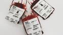 Top Blood Donating State: ब्लड डोनेशन की रेस में टॉप पर है देश का यह राज्य, जानें दूसरे और तीसरे नंबर पर कौन?