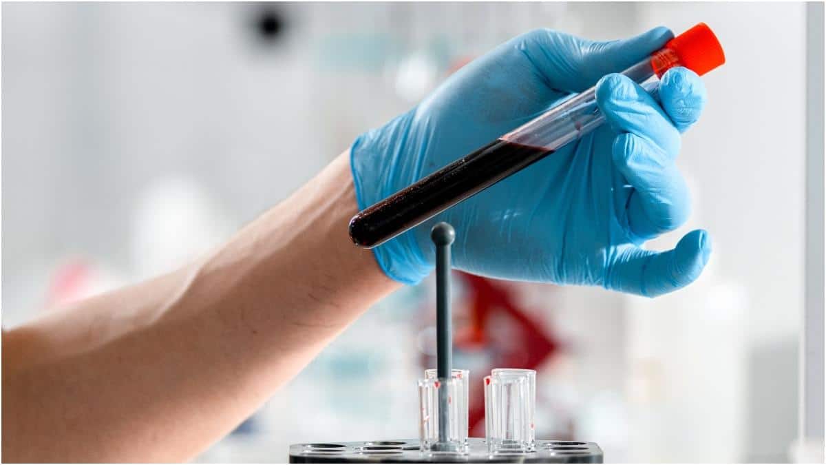Blood Tests : రొటీన్​కు భిన్నంగా వైద్యులు సూచిస్తోన్న 5 రక్త పరీక్షలు.. వీటితో వ్యాధులు ముందుగానే గుర్తించవచ్చా?