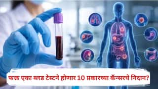 Shield Multi Cancer Detection: फक्त एका ब्लड टेस्टने होणार 10 प्रकारच्या कॅन्सरचे निदान? भारतात क्रांतिकारी चाचणी लाँच, जाणून घ्या A टू Z माहिती