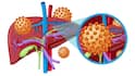 When Is Hepatitis An Emergency?: హెపటైటిస్ ఎప్పుడు ప్రాణాంతకమవుతుంది? లీవర్ ఫెయిల్యూర్‌ ప్రమాదాన్ని చెప్పే ఆరు రెడ్‌ఫ్లాగ్స్ ఇవే!
