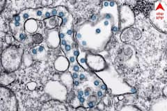 Cyclospora Infection: ਤੇਜ਼ੀ ਨਾਲ ਫੈਲ ਰਹੀ ਇਹ ਖ਼ਤਰਨਾਕ ਬਿਮਾਰੀ , ਦਿਨ ਵਿੱਚ 30 ਵਾਰ ਜਾਣਾ ਪੈਂਦਾ ਹੈ ਟਾਇਲਟ , ਦਵਾਈਆਂ ਹੋ ਰਹੀਆਂ ਬੇਕਾਰ।